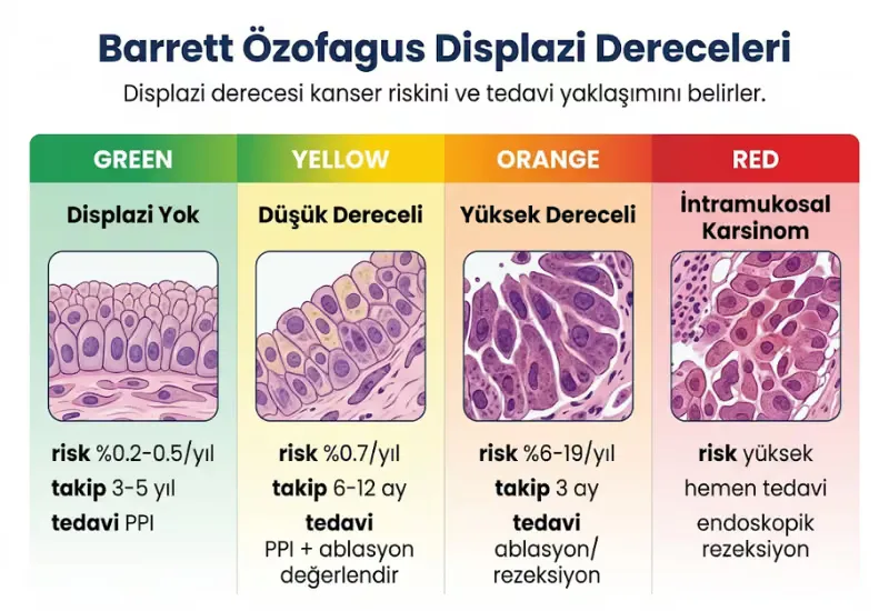 Barrett özofagus displazi dereceleri tablo kanser riski takip