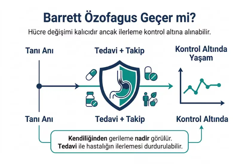 Barrett özofagus geçer mi tedavi ile kontrol