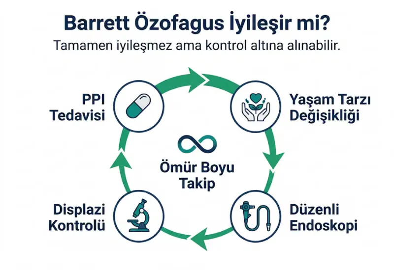 Barrett özofagus iyileşme süreci tedavi takip