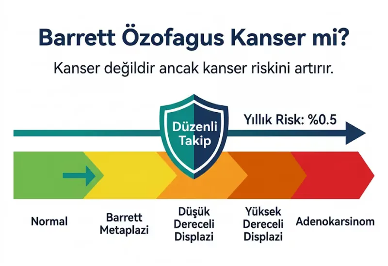Barrett özofagus kanser riski displazi adenokarsinom