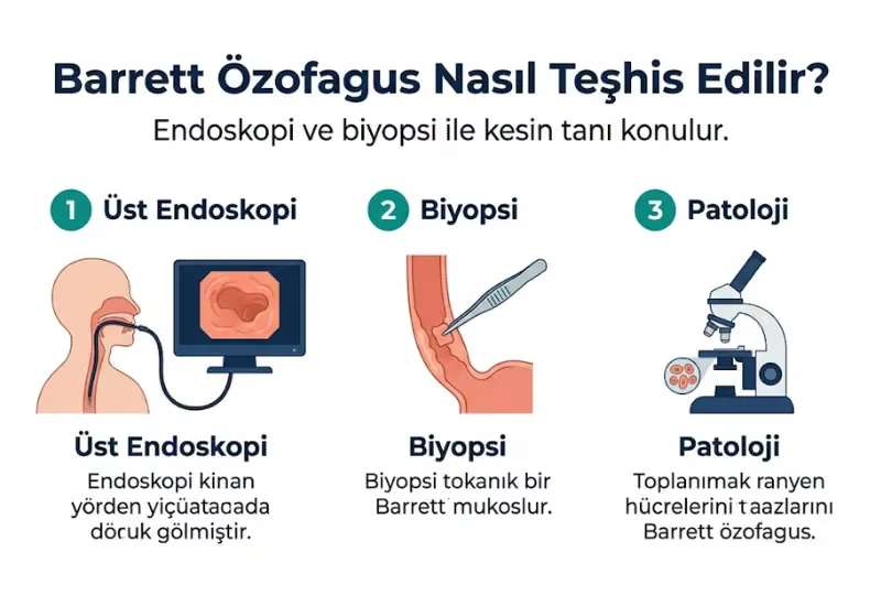 Barrett özofagus teşhis endoskopi biyopsi patoloji