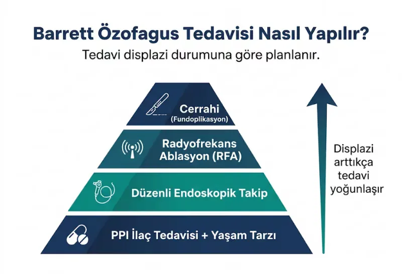 Barrett özofagus tedavisi ilaç endoskopi yaşam tarzı