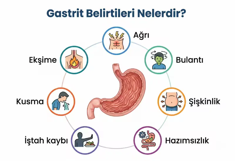 Gastrit belirtilerini anlatan infografik