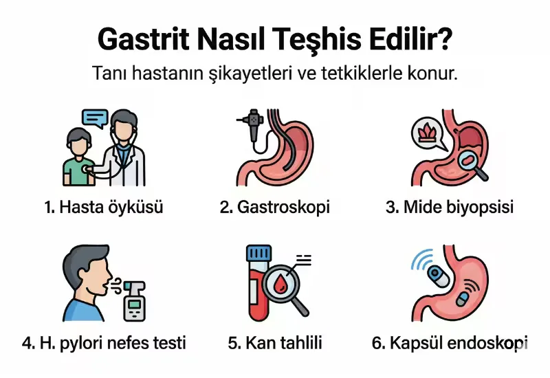 Gastrit teşhis yöntemlerini anlatan infografik