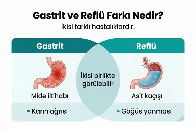 Gastrit ve reflü farkını anlatan infografik