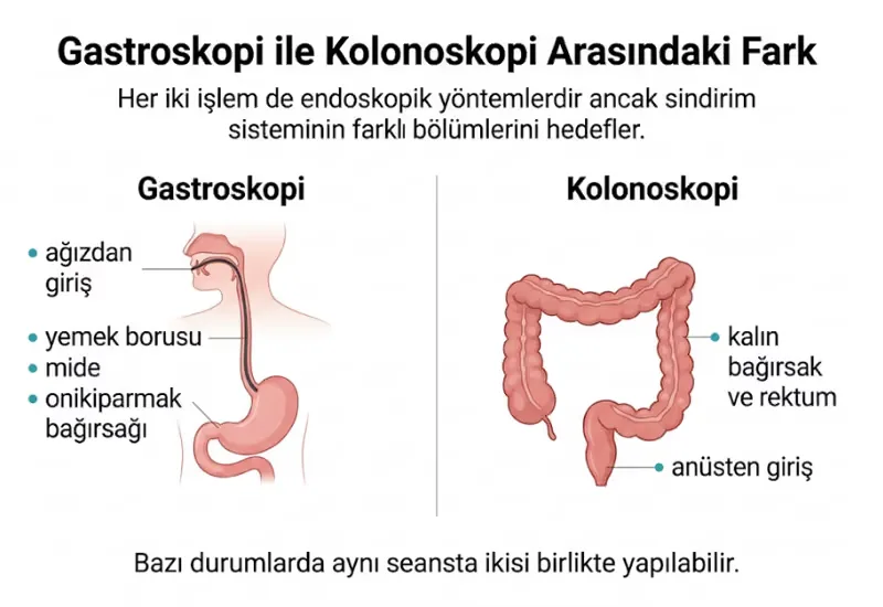 Gastroskopi kolonoskopi farkı infografiği