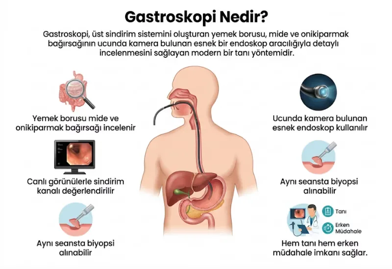 Gastroskopi nedir infografiği