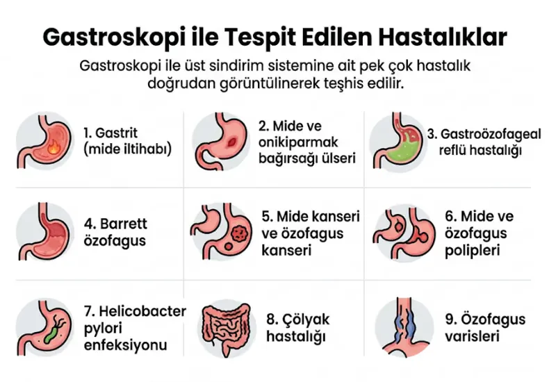 Gastroskopi ile tespit edilen hastalıklar infografiği
