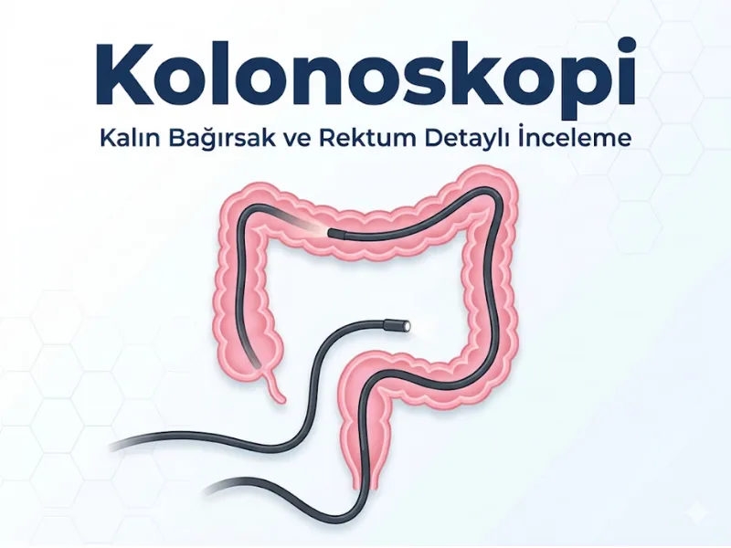 Kolonoskopi kalın bağırsak ve rektum detaylı inceleme