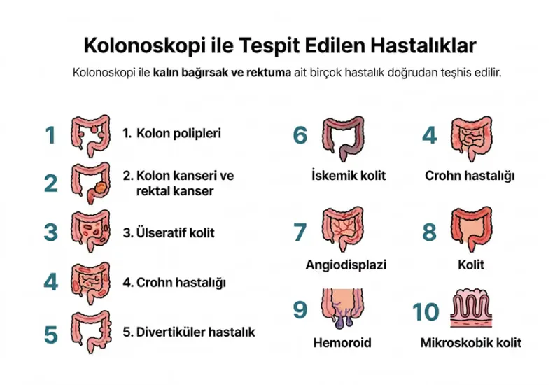 Kolonoskopi biyopsi polip alınması polipektomi