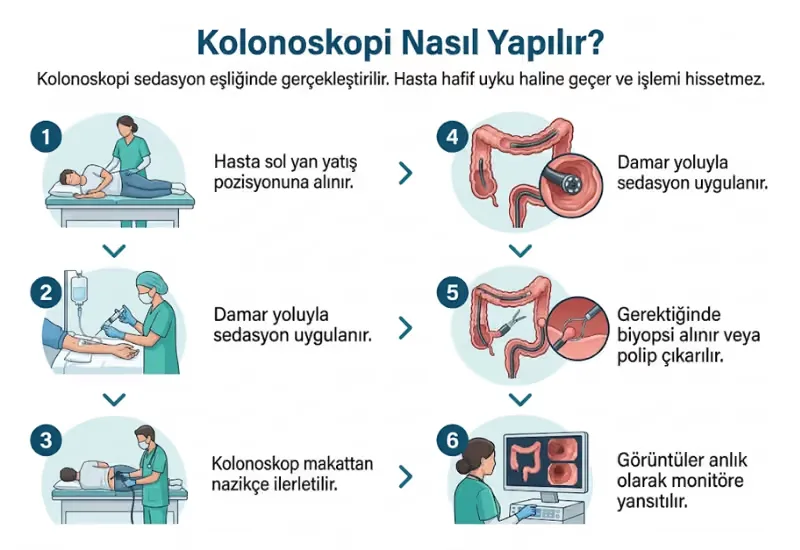 Kolonoskopi nasıl yapılır sedasyon endoskop işlem adımları