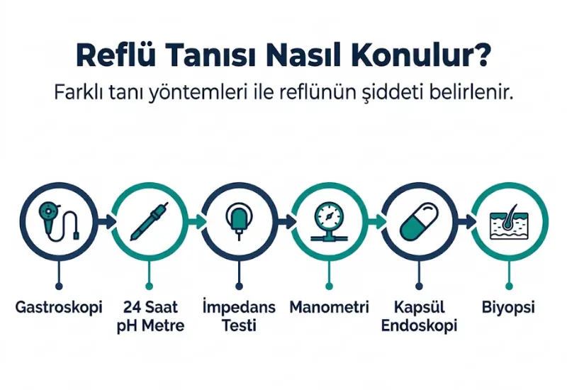 Reflü tanı yöntemleri infografiği