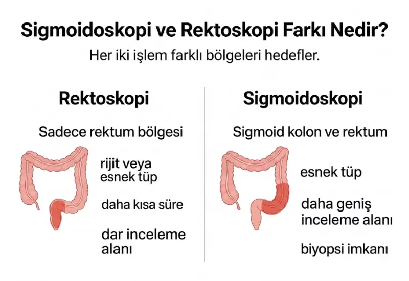 Rektosigmoidoskopi kolonoskopi farkı infografiği