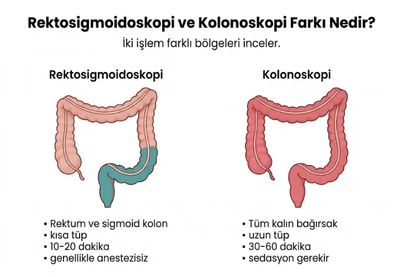 Sigmoidoskopi rektoskopi rektosigmoidoskopi farkı infografiği