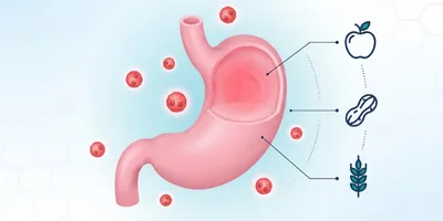 Eozinofilik Gastrit kapak görseli