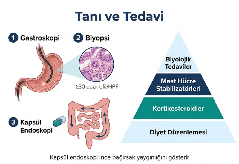 Eozinofilik gastrit tan\u0131 tedavi kaps\u00fcl endoskopi gastroskopi biyopsi