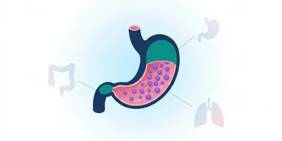 Granülomatöz Gastrit kapak görseli