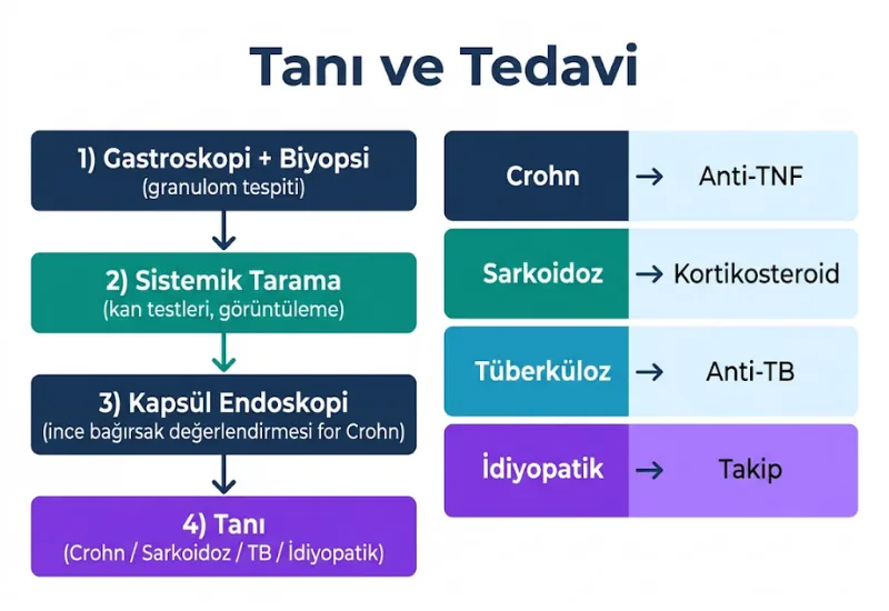 Granülomatöz gastrit tanı tedavi kapsül endoskopi crohn ayırıcı tanı
