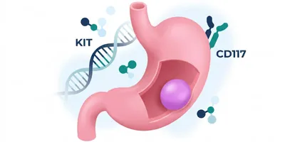GIST Gastrointestinal Stromal Tümör kapak görseli