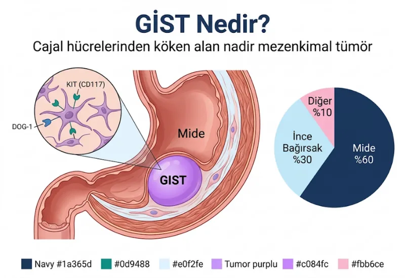 GIST nedir gastrointestinal stromal t\u00fcm\u00f6r cajal h\u00fccreleri